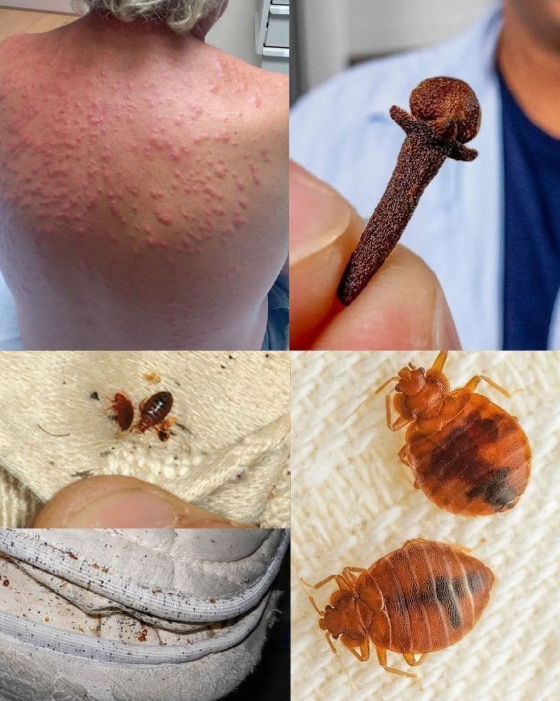 ⚠️ BE CAREFUL, If you spot these dots on your skin, it means you have Ca…see more
